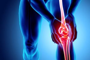 Η αρθροπλαστική επέμβαση ισχίου και γόνατος : Πότε και σε ποιες περιπτώσεις ενδείκνυται;